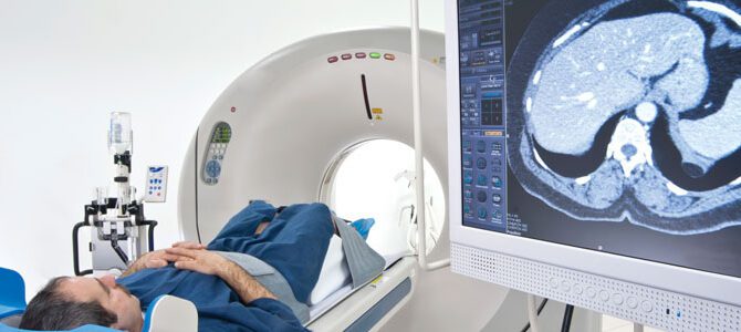 What You Might Not Know About CT Scans