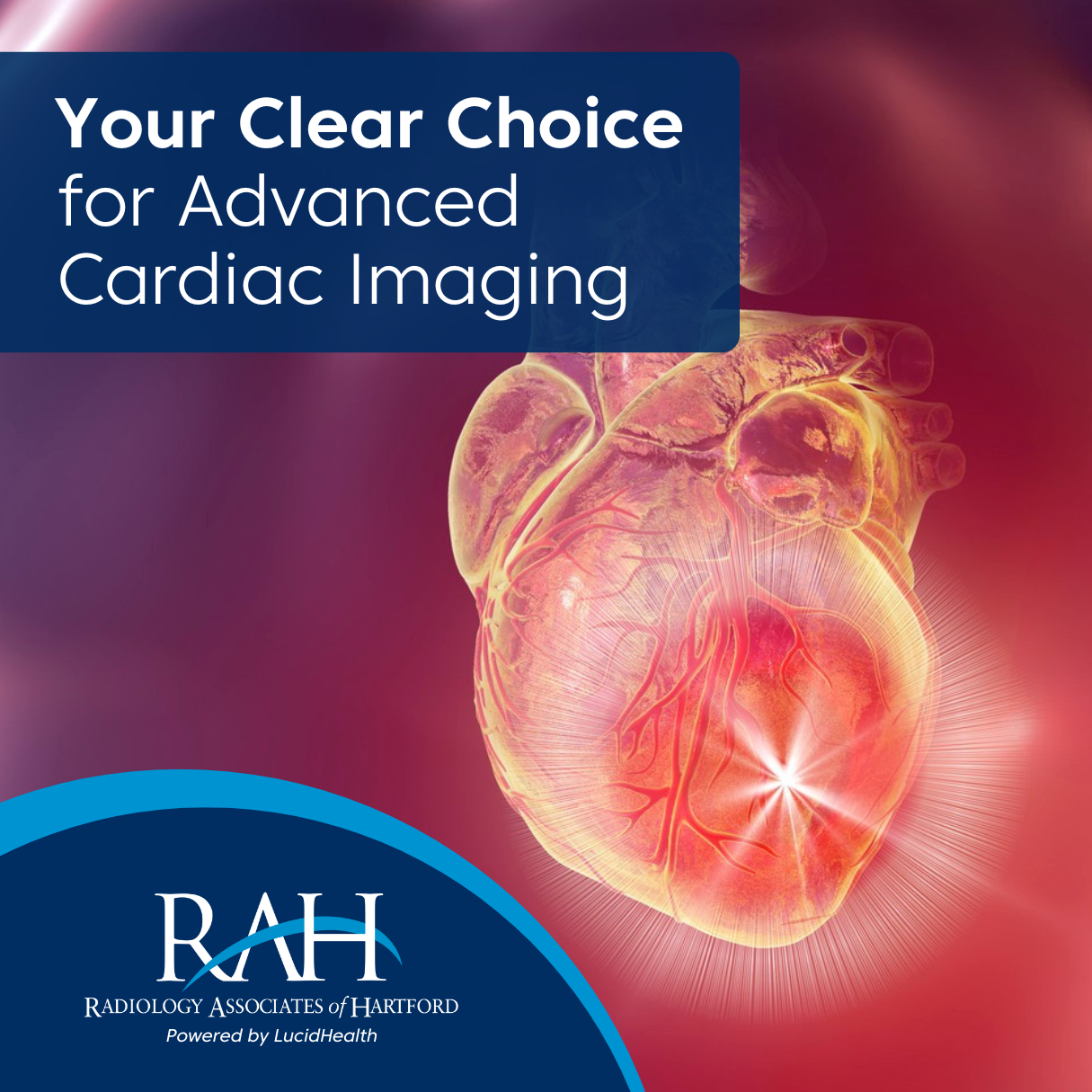 Cardiac Imaging Graphic